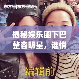 揭秘娛樂圈下巴整容明星，誰悄悄整過下巴？