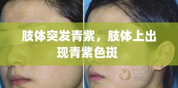 肢體突發(fā)青紫，肢體上出現(xiàn)青紫色斑 