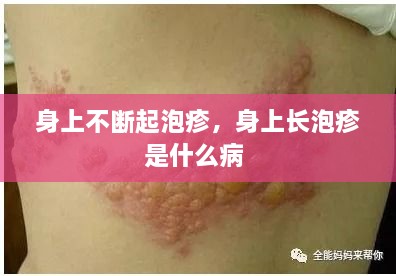 身上不斷起泡疹，身上長泡疹是什么病 
