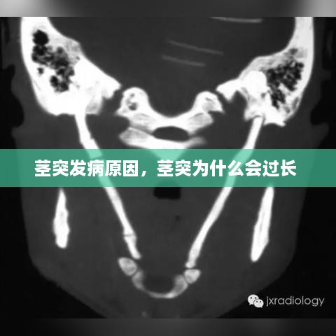 莖突發(fā)病原因，莖突為什么會過長 