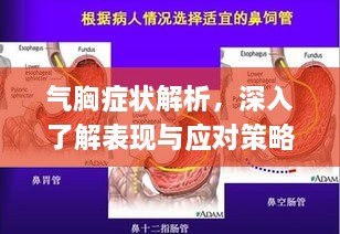 氣胸癥狀解析，深入了解表現(xiàn)與應對策略