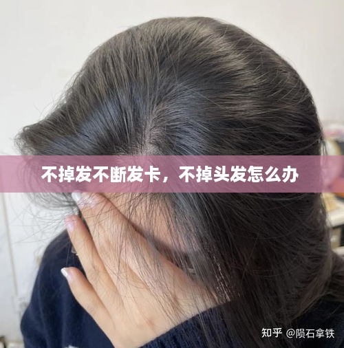 不掉發(fā)不斷發(fā)卡，不掉頭發(fā)怎么辦 
