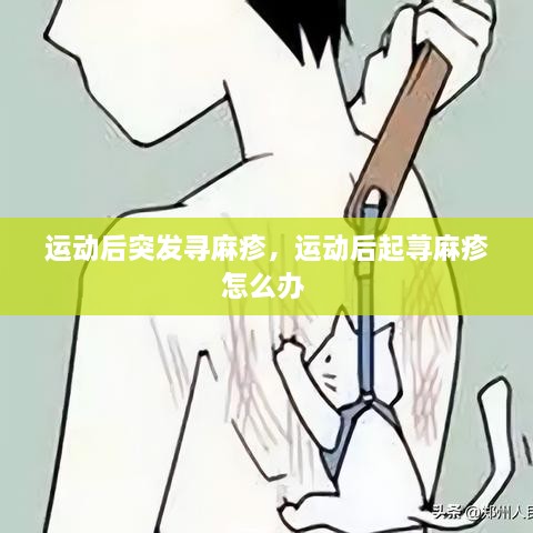 運動后突發(fā)尋麻疹，運動后起蕁麻疹怎么辦 