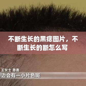 不斷生長(zhǎng)的黑痣圖片，不斷生長(zhǎng)的斷怎么寫 