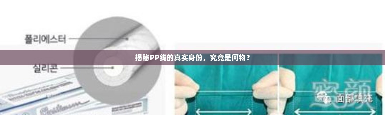 揭秘PP線的真實身份，究竟是何物？