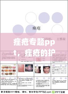 痤瘡專題ppt，痤瘡的護(hù)理ppt 