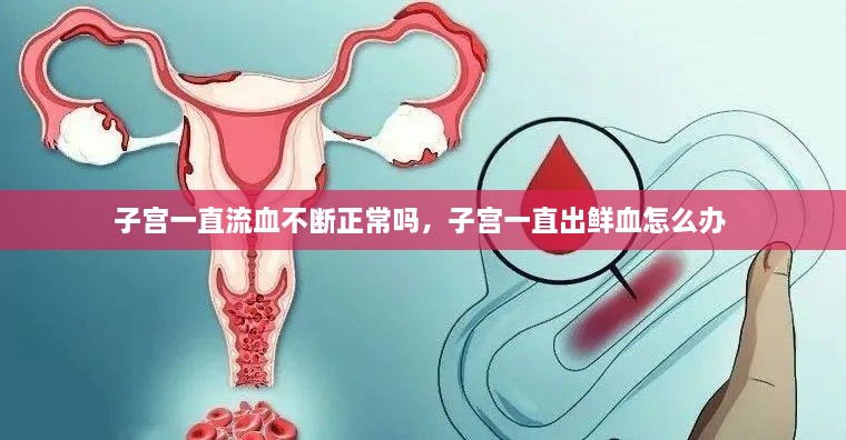 子宮一直流血不斷正常嗎，子宮一直出鮮血怎么辦 