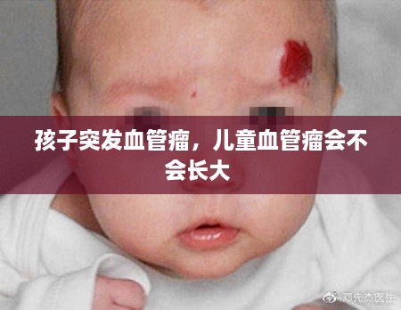 孩子突發(fā)血管瘤，兒童血管瘤會不會長大 