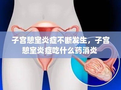 子宮憩室炎癥不斷發(fā)生，子宮憩室炎癥吃什么藥消炎 