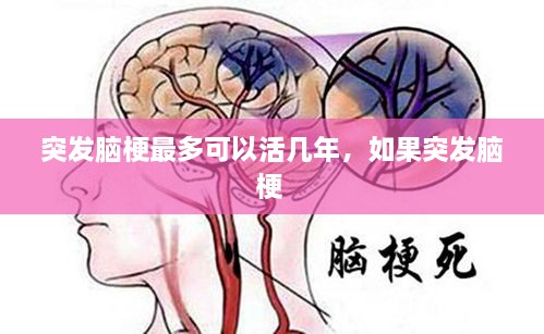 突發(fā)腦梗最多可以活幾年，如果突發(fā)腦梗 
