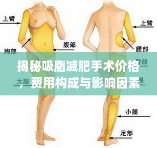 揭秘吸脂減肥手術(shù)價格，費用構(gòu)成與影響因素全解析